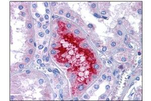 Human Kidney: Formalin-Fixed, Paraffin-Embedded (FFPE) (MATN1 抗体  (C-Term))
