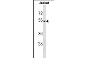 ZN Antibody (Center) (ABIN1538123 and ABIN2849842) western blot analysis in Jurkat cell line lysates (35 μg/lane). (ZNF703 抗体  (AA 226-254))
