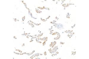 Immunocytochemistry (ICC) image for anti-HRas proto-oncogene, GTPase (HRAS) (AA 50-100) antibody (ABIN7795745)