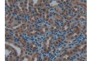 Detection of ACP5 in Rat Kidney Tissue using Polyclonal Antibody to Acid Phosphatase 5, Tartrate Resistant (ACP5) (ACP5 抗体  (AA 29-296))