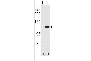 Western blot analysis of MVP using rabbit polyclonal MVP C-term Antibody using 293 cell lysates (2 ug/lane) either nontransfected (Lane 1) or transiently transfected with the MVP gene (Lane 2).