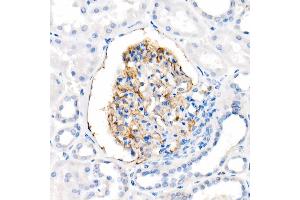 Immunohistochemistry of paraffin-embedded Human kidney using CD35/CR1 antibody (ABIN7266477) at dilution of 50 (40x lens). (CD35 抗体)