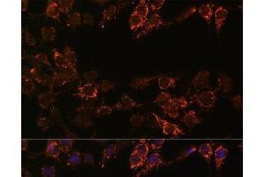 Immunofluorescence analysis of C6 cells using MAOA Polyclonal Antibody at dilution of 1:100. (Monoamine Oxidase A 抗体)