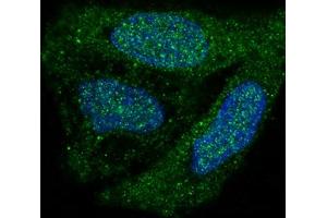 Immunofluorescent analysis of HeLa cells, using p38 MAPK Antibody.