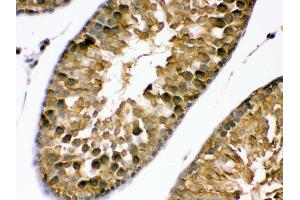 Anti- PDPK1 Picoband antibody, IHC(P) IHC(P): Rat Testis Tissue (PDPK1 抗体  (C-Term))