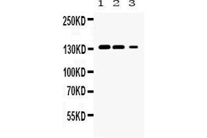 Western blot analysis of JAK1 expression in rat kidney extract ( Lane 1), mouse kidney extract ( Lane 2) and HELA whole cell lysates ( Lane 3). (JAK1 抗体  (N-Term))