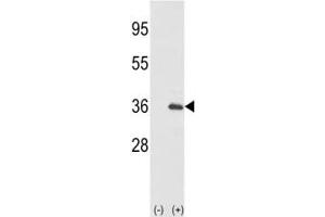 Western Blotting (WB) image for anti-Interleukin 1 alpha (IL1A) (AA 65-94) antibody (ABIN3031428)