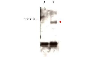 Image no. 1 for anti-Signal Transducer and Activator of Transcription 1, 91kDa (STAT1) (pTyr701) antibody (ABIN401047) (STAT1 抗体  (pTyr701))
