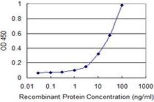 Detection limit for recombinant GST tagged STIM1 is 0. (STIM1 抗体  (AA 24-685))