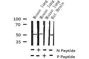 Western blot analysis of Phospho-AML1 (Ser303) expression in various lysates (RUNX1 抗体  (pSer304))