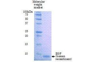 SDS-PAGE (SDS) image for Epidermal Growth Factor (EGF) (Active) protein (ABIN2452188) (EGF 蛋白)