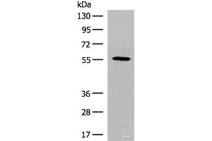 Western blot analysis of HepG2 cell lysate using GPR22 Polyclonal Antibody at dilution of 1:500 (GPR22 抗体)