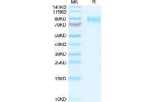 SDS-PAGE (SDS) image for Colony Stimulating Factor 1 Receptor (CSF1R) (AA 20-511) protein (His tag) (ABIN7274430)