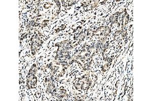 IHC analysis of C-Jun/JUN using anti-C-Jun/JUN antibody (ABIN7601421). (C-JUN 抗体  (AA 35-331))