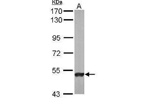 WB Image Sample (50 ug of whole cell lysate) A: Mouse brain 7. (ABAT 抗体  (C-Term))