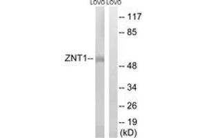 Western blot analysis of extracts from LOVO cells, using SLC30A1 Antibody. (SLC30A1 抗体  (AA 201-250))