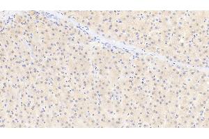 Detection of GSTa1 in Human Liver Tissue using Polyclonal Antibody to Glutathione S Transferase Alpha 1 (GSTa1) (GSTA1 抗体  (AA 2-222))