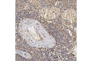 IHC analysis of SUCLG2 using anti-SUCLG2 antibody (ABIN7601694).