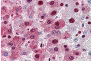 Human Liver (formalin-fixed, paraffin-embedded) stained with NPM1 antibody ABIN364324 at 5 ug/ml followed by biotinylated anti-mouse IgG secondary antibody ABIN481714, alkaline phosphatase-streptavidin and chromogen. (NPM1 抗体  (AA 81-294))