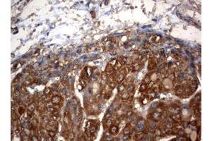 Image no. 1 for anti-3-Oxoacyl-ACP Synthase, Mitochondrial (OXSM) (AA 78-343) antibody (ABIN1491676) (OXSM 抗体  (AA 78-343))