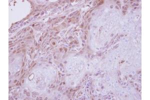 IHC-P Image Immunohistochemical analysis of paraffin-embedded Ca922 xenograft, using TPRKB, antibody at 1:250 dilution. (TPRKB 抗体)