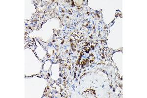 Immunohistochemistry of paraffin-embedded rat lung using Gelsolin Rabbit pAb (ABIN7267365) at dilution of 1:50 (40x lens).