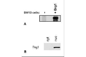 Western Blotting (WB) image for anti-SWI/SNF Related, Matrix Associated, Actin Dependent Regulator of Chromatin, Subfamily A, Member 4 (SMARCA4) (C-Term) antibody (ABIN343708)