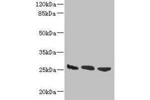 Western blot All lanes: DNAJB8 antibody at 8 μg/mL Lane 1: Hela whole cell lysate Lane 2: Mouse brain tissue Lane 3: Mouse liver tissue Secondary Goat polyclonal to rabbit IgG at 1/10000 dilution Predicted band size: 26 kDa Observed band size: 26 kDa