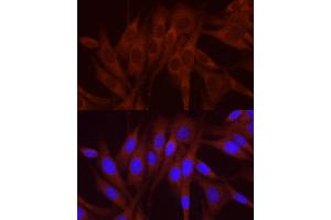 Immunofluorescence analysis of NIH/3T3 cells using NUMB Rabbit pAb (ABIN6129424, ABIN6144943, ABIN6144944 and ABIN6224990) at dilution of 1:250 (40x lens). (NUMB 抗体  (AA 521-640))
