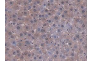 Detection of AT in Rat Liver Tissue using Polyclonal Antibody to Antithrombin (AT) (SERPINC1 抗体  (AA 33-465))