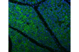 IF analysis of Citrin/SLC25A13 using anti-Citrin/SLC25A13 antibody (ABIN7599512). (slc25a13 抗体  (AA 1-643))