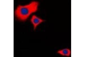 Immunofluorescent analysis of HSPB2 staining in Hela cells. (HSPB2 抗体  (C-Term))