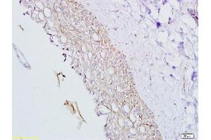 Formalin-fixed and paraffin embedded rat ovary tissue labeled with Anti-Inhibin Alpha Polyclonal Antibody, Unconjugated  at 1:200, followed by conjugation to the secondary antibody and DAB staining (Inhibin alpha 抗体  (AA 301-366))