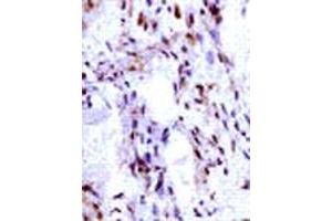 Immunohistochemical analysis of IGF2 expression in human ovarian vascular endothelial cells. (IGF2 抗体  (C-Term))