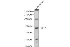 Western blot analysis of extracts of Mouse liver, using IRF7 antibody (ABIN1513103, ABIN3020650, ABIN3020652 and ABIN6213641) at 1:1000 dilution. (IRF7 抗体  (AA 257-516))