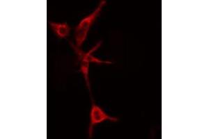 ABIN6274808 staining COLO205 cells by IF/ICC. (LYPLA1 抗体  (Internal Region))
