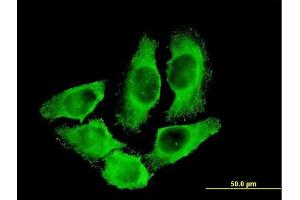 Immunofluorescence of monoclonal antibody to CKM on HeLa cell. (CKM 抗体  (AA 282-381))