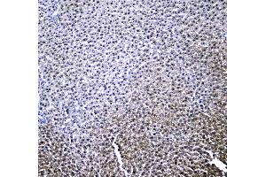 IHC analysis of RXRA using anti-RXRA antibody . (Retinoid X Receptor alpha 抗体  (AA 226-462))