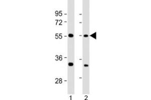 Western blot testing of human 1) 293T/17 and 2) HeLa cell lysate with AAAS antibody at 1:2000. (Adracalin 抗体  (AA 395-425))