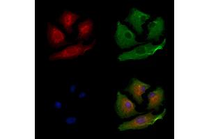 ABIN6264206 and ABIN6279656 staining  cells by IF/ICC. (PIGP 抗体  (Internal Region))