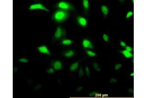 Image no. 2 for anti-Chloride Intracellular Channel 3 (CLIC3) (AA 137-237) antibody (ABIN465974) (CLIC3 抗体  (AA 137-237))