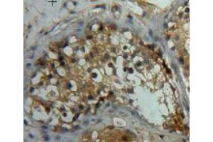 IHC-P analysis of testis tissue, with DAB staining. (LEFTY2 抗体  (AA 245-356))