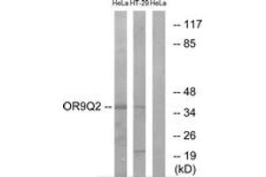 Western Blotting (WB) image for anti-Olfactory Receptor, Family 9, Subfamily Q, Member 2 (OR9Q2) (AA 232-281) antibody (ABIN1535972)