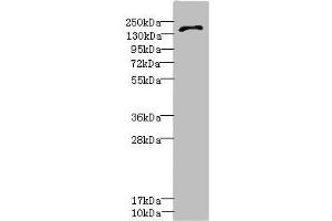 Western blot All lanes: GRIN2D antibody IgG at 3. (GRIN2D 抗体  (AA 330-480))