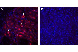 Expression of 5-HT2A in rat dorsal raphe nucleus.