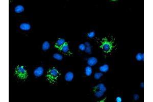 Anti-DLD mouse monoclonal antibody (ABIN2454923) immunofluorescent staining of COS7 cells transiently transfected by pCMV6-ENTRY DLD (RC200639). (DLD 抗体)