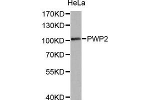 Western Blotting (WB) image for anti-PWP2 (Periodic Tryptophan Protein) Homolog (PWP2H) antibody (ABIN1876958) (PWP2 抗体)