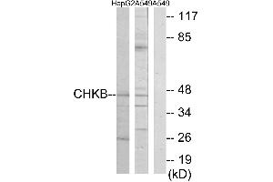 Western blot analysis of extracts from HepG2 cells and A549 cells, using CHKB antibody. (CHKB 抗体)