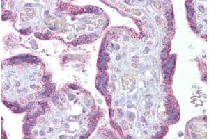 Immunohistochemistry (IHC) image for anti-Transient Receptor Potential Cation Channel, Subfamily C, Member 4 (TRPC4) (C-Term) antibody (ABIN958328)
