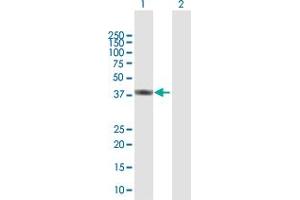 Western Blotting (WB) image for anti-ATPase, H+ Transporting, Lysosomal 42kDa, V1 Subunit C2 (ATP6V1C2) (AA 1-381) antibody (ABIN531408)